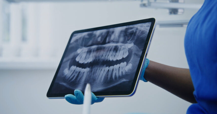 Dental insurance plans